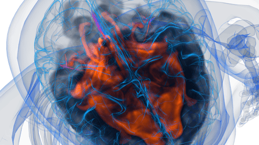 Neuroinflammation image 2